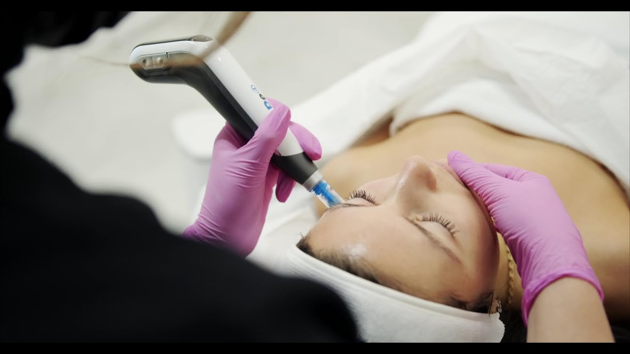 Best Microneedling Price