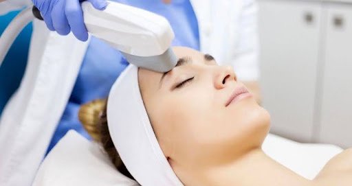 IPL Laser Machine