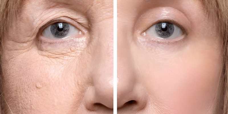 steptodown.com419756